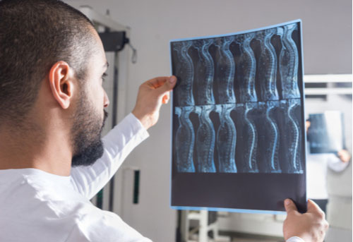 Doctor viewing x-ray of spine injury